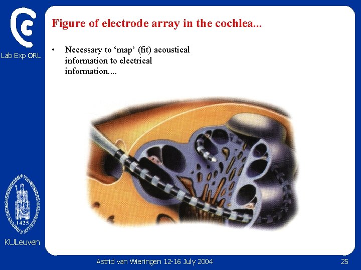 Figure of electrode array in the cochlea. . . Lab Exp ORL • Necessary Figure of electrode array in the cochlea. . . Lab Exp ORL • Necessary