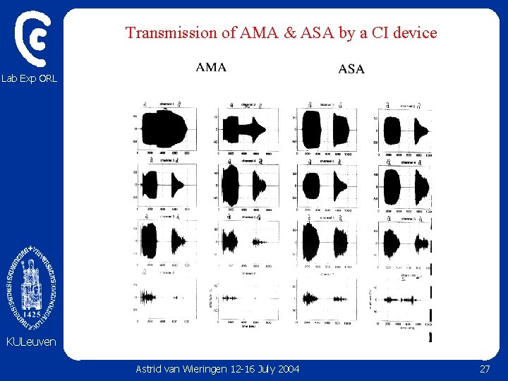 Transmission of AMA & ASA by a CI device Lab Exp ORL KULeuven Astrid Transmission of AMA & ASA by a CI device Lab Exp ORL KULeuven Astrid