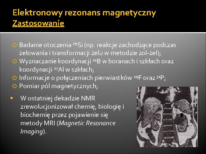 Elektronowy rezonans magnetyczny Zastosowanie Badanie otoczenia 29 Si (np. reakcje zachodzące podczas żelowania i