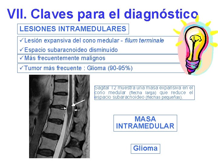 VII. Claves para el diagnóstico LESIONES INTRAMEDULARES üLesión expansiva del cono medular - filum