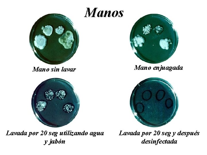 Manos Mano sin lavar Mano enjuagada Lavada por 20 seg utilizando agua y jabón