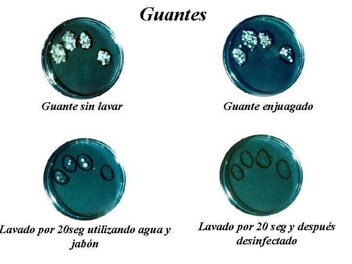 Guantes Guante sin lavar Guante enjuagado Lavado por 20 seg utilizando agua y jabón