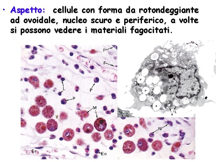  • Aspetto: cellule con forma da rotondeggiante ad ovoidale, nucleo scuro e periferico,