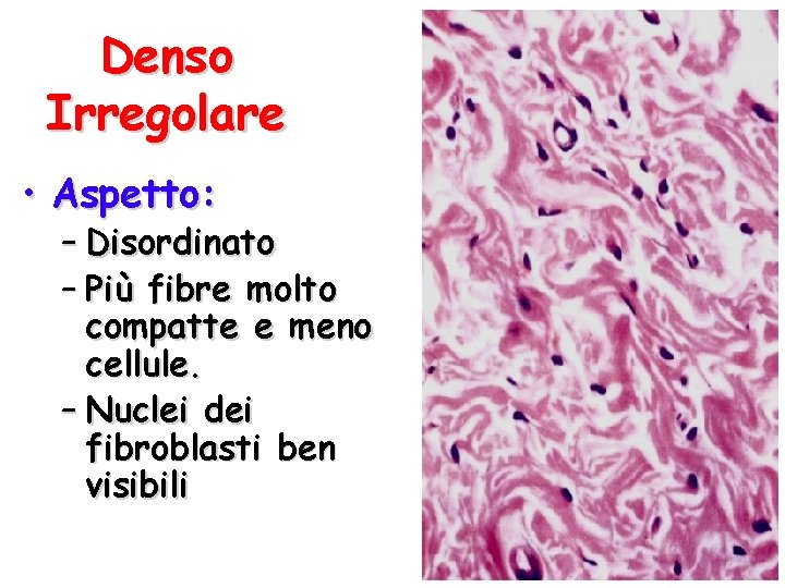 Denso Irregolare • Aspetto: – Disordinato – Più fibre molto compatte e meno cellule.