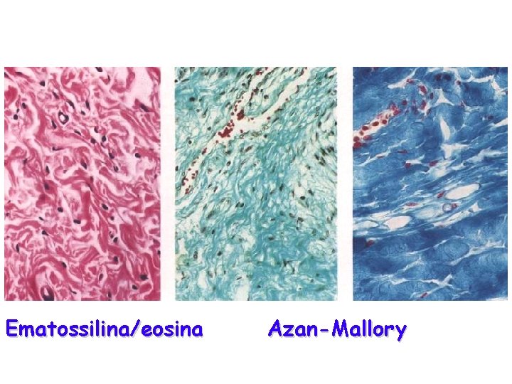 Ematossilina/eosina Azan-Mallory 