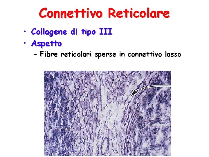 Connettivo Reticolare • Collagene di tipo III • Aspetto – Fibre reticolari sperse in