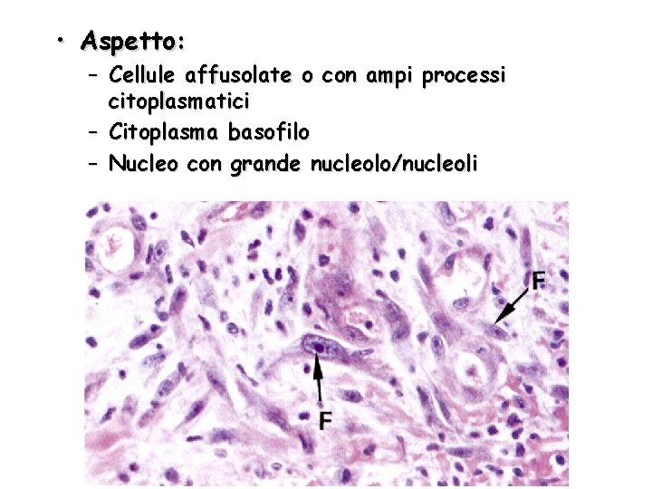  • Aspetto: – Cellule affusolate o con ampi processi citoplasmatici – Citoplasma basofilo