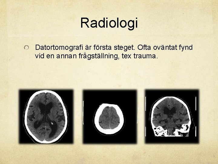 Radiologi Datortomografi är första steget. Ofta oväntat fynd vid en annan frågställning, tex trauma.