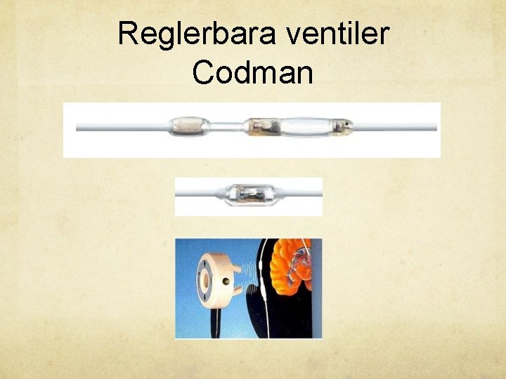 Reglerbara ventiler Codman 