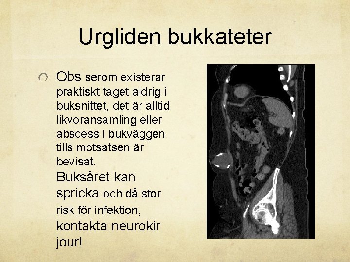 Urgliden bukkateter Obs serom existerar praktiskt taget aldrig i buksnittet, det är alltid likvoransamling