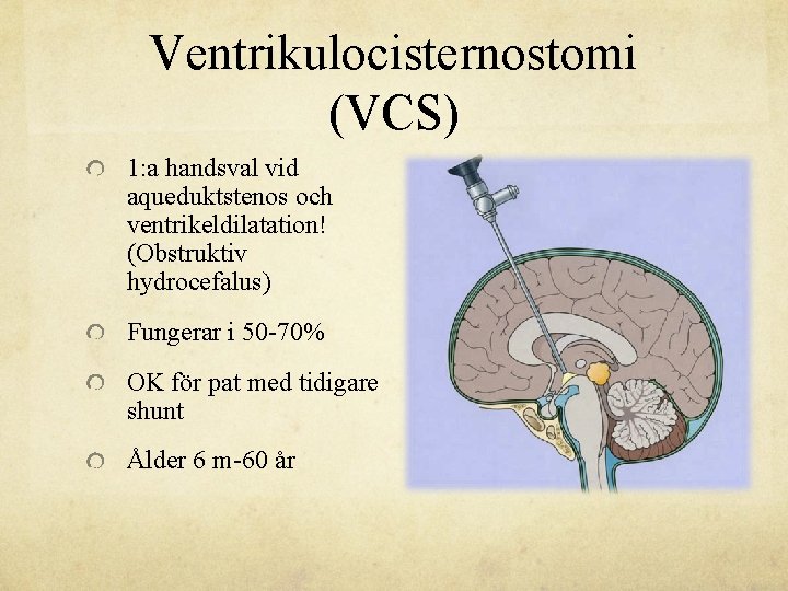 Ventrikulocisternostomi (VCS) 1: a handsval vid aqueduktstenos och ventrikeldilatation! (Obstruktiv hydrocefalus) Fungerar i 50