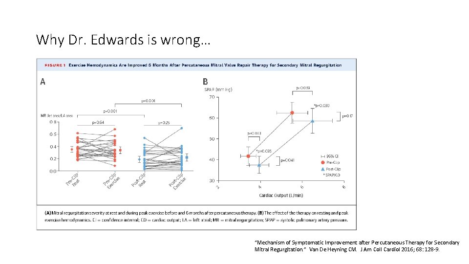 Why Dr. Edwards is wrong… “Mechanism of Symptomatic Improvement after Percutaneous Therapy for Secondary