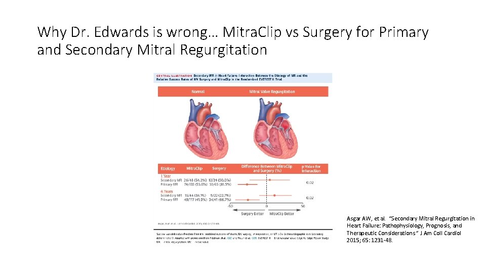 Why Dr. Edwards is wrong… Mitra. Clip vs Surgery for Primary and Secondary Mitral