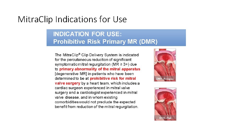 Mitra. Clip Indications for Use 