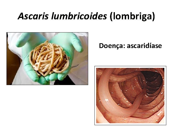 Ascaris lumbricoides (lombriga) Doença: ascaridíase 