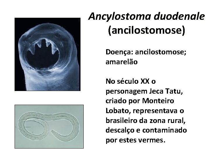 Ancylostoma duodenale (ancilostomose) Doença: ancilostomose; amarelão No século XX o personagem Jeca Tatu, criado