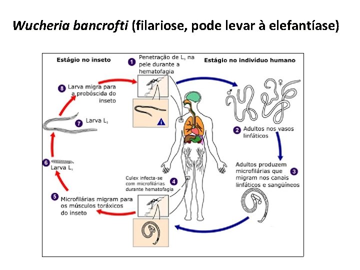 Wucheria bancrofti (filariose, pode levar à elefantíase) 
