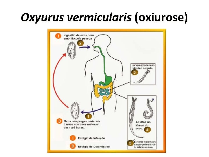 Oxyurus vermicularis (oxiurose) 