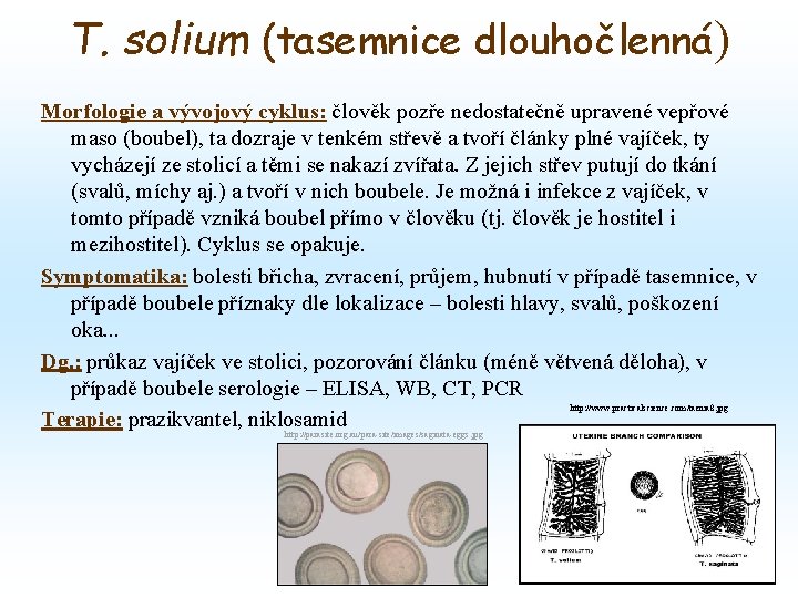 T. solium (tasemnice dlouhočlenná) Morfologie a vývojový cyklus: člověk pozře nedostatečně upravené vepřové maso