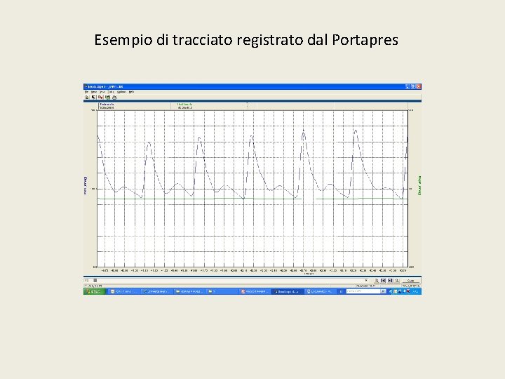 Esempio di tracciato registrato dal Portapres 