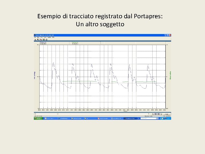 Esempio di tracciato registrato dal Portapres: Un altro soggetto 