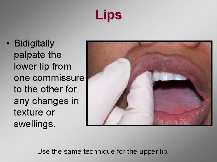 Module 5 Oral Cancer Examination Oral Cancer Exam