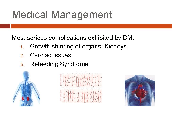 Medical Management Most serious complications exhibited by DM. 1. Growth stunting of organs: Kidneys