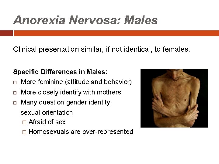 Anorexia Nervosa: Males Clinical presentation similar, if not identical, to females. Specific Differences in
