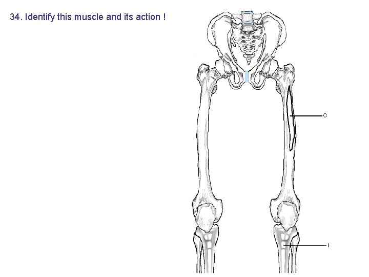 34. Identify this muscle and its action ! 34. Identify this muscle and its action !
