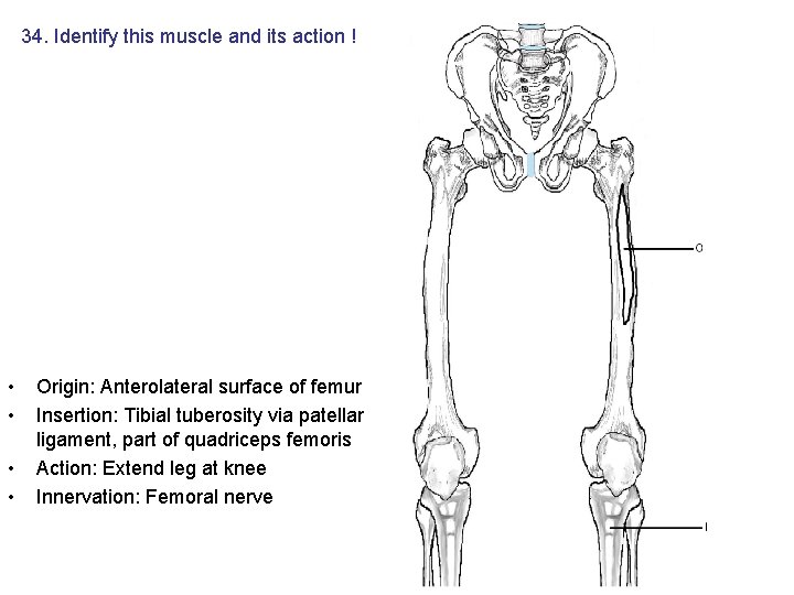 34. Identify this muscle and its action ! • • Origin: Anterolateral surface of 34. Identify this muscle and its action ! • • Origin: Anterolateral surface of