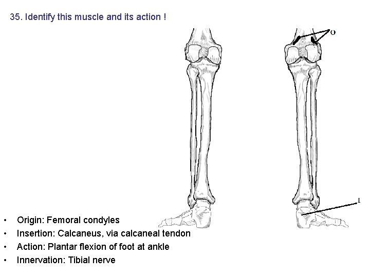 35. Identify this muscle and its action ! • • Origin: Femoral condyles Insertion: 35. Identify this muscle and its action ! • • Origin: Femoral condyles Insertion: