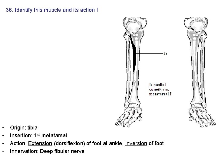 36. Identify this muscle and its action ! • • Origin: tibia Insertion: 1 36. Identify this muscle and its action ! • • Origin: tibia Insertion: 1