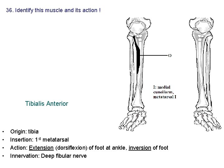 36. Identify this muscle and its action ! Tibialis Anterior • • Origin: tibia 36. Identify this muscle and its action ! Tibialis Anterior • • Origin: tibia