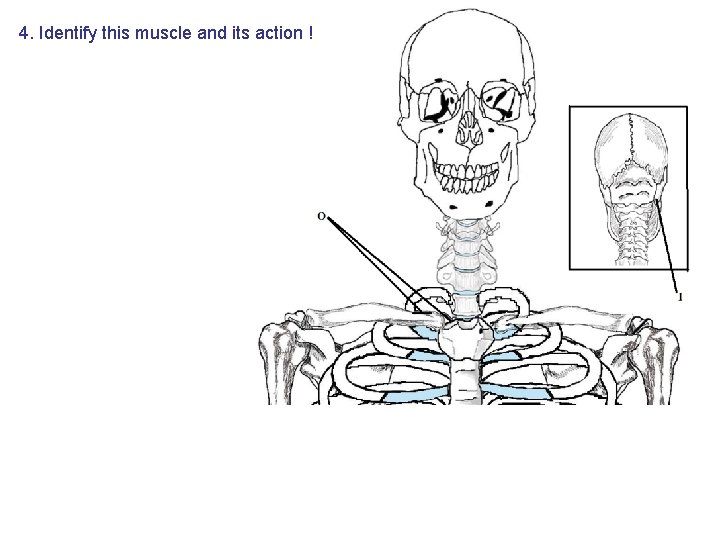 4. Identify this muscle and its action ! 4. Identify this muscle and its action !