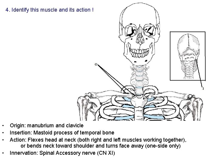 4. Identify this muscle and its action ! • • Origin: manubrium and clavicle 4. Identify this muscle and its action ! • • Origin: manubrium and clavicle