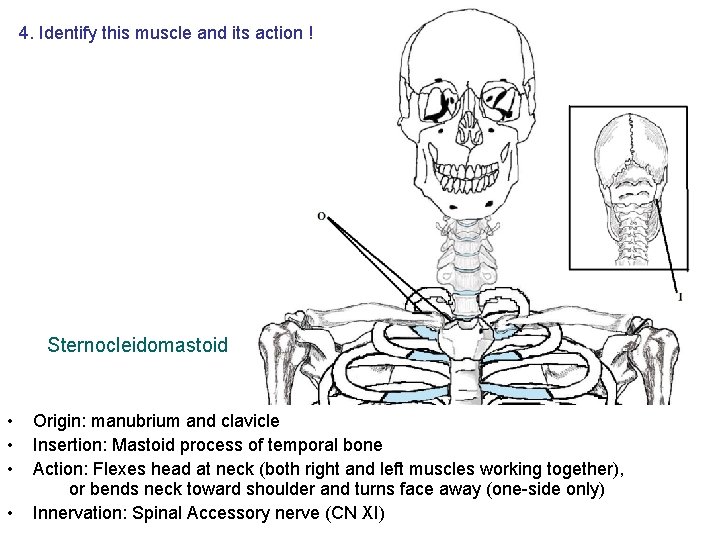 4. Identify this muscle and its action ! Sternocleidomastoid • • Origin: manubrium and 4. Identify this muscle and its action ! Sternocleidomastoid • • Origin: manubrium and