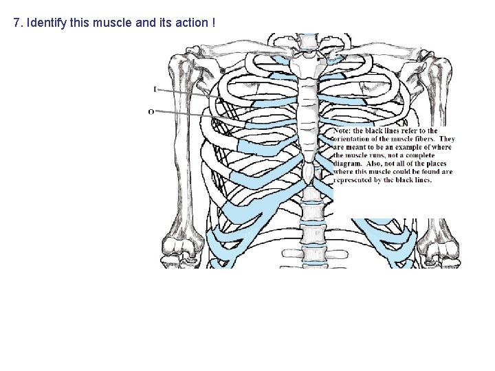 7. Identify this muscle and its action ! 7. Identify this muscle and its action !