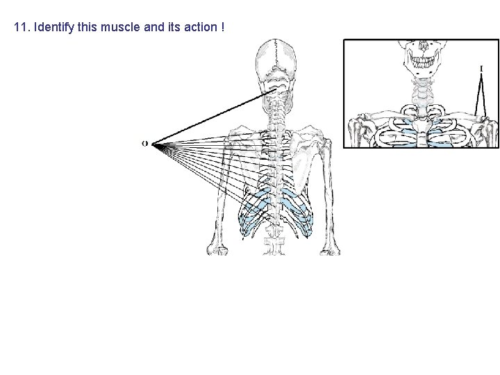 11. Identify this muscle and its action ! 11. Identify this muscle and its action !
