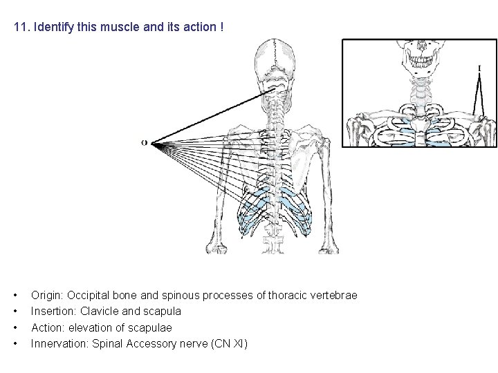 11. Identify this muscle and its action ! • • Origin: Occipital bone and 11. Identify this muscle and its action ! • • Origin: Occipital bone and