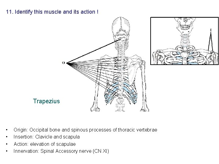 11. Identify this muscle and its action ! Trapezius • • Origin: Occipital bone 11. Identify this muscle and its action ! Trapezius • • Origin: Occipital bone