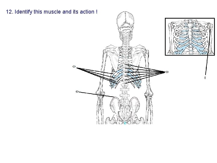 12. Identify this muscle and its action ! 12. Identify this muscle and its action !