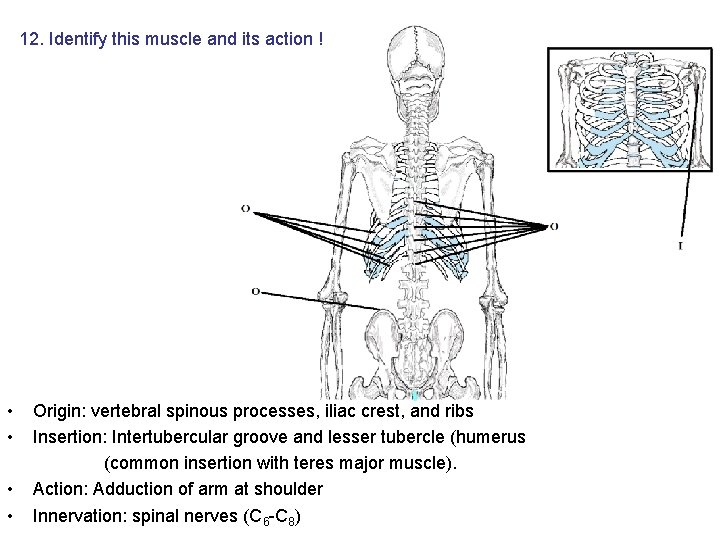 12. Identify this muscle and its action ! • • Origin: vertebral spinous processes, 12. Identify this muscle and its action ! • • Origin: vertebral spinous processes,