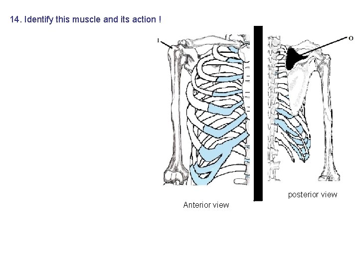 14. Identify this muscle and its action ! posterior view Anterior view 14. Identify this muscle and its action ! posterior view Anterior view