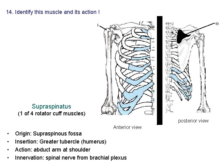14. Identify this muscle and its action ! Supraspinatus (1 of 4 rotator cuff 14. Identify this muscle and its action ! Supraspinatus (1 of 4 rotator cuff