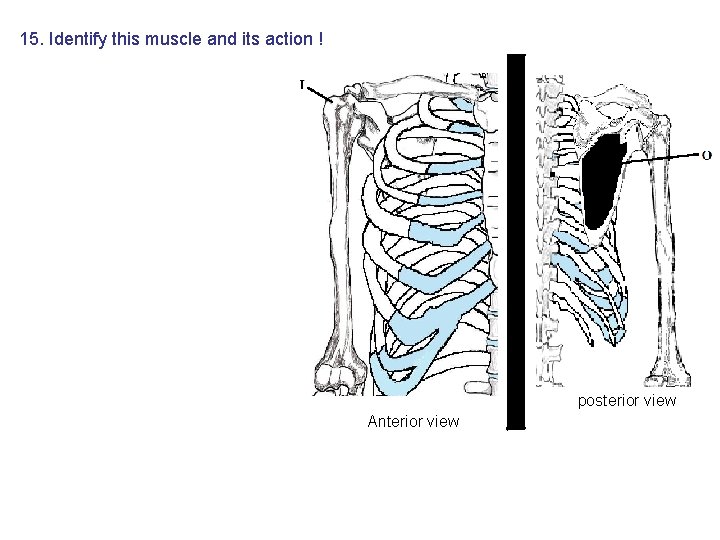 15. Identify this muscle and its action ! posterior view Anterior view 15. Identify this muscle and its action ! posterior view Anterior view