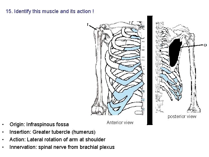 15. Identify this muscle and its action ! posterior view • • Anterior view 15. Identify this muscle and its action ! posterior view • • Anterior view