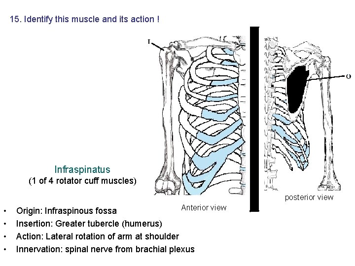 15. Identify this muscle and its action ! Infraspinatus (1 of 4 rotator cuff 15. Identify this muscle and its action ! Infraspinatus (1 of 4 rotator cuff
