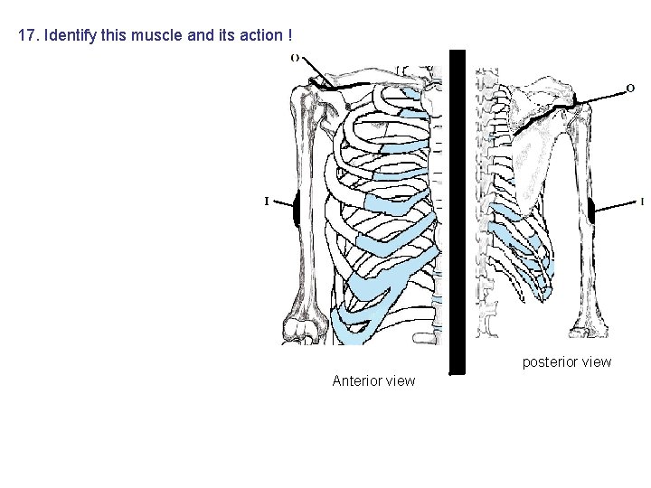 17. Identify this muscle and its action ! posterior view Anterior view 17. Identify this muscle and its action ! posterior view Anterior view