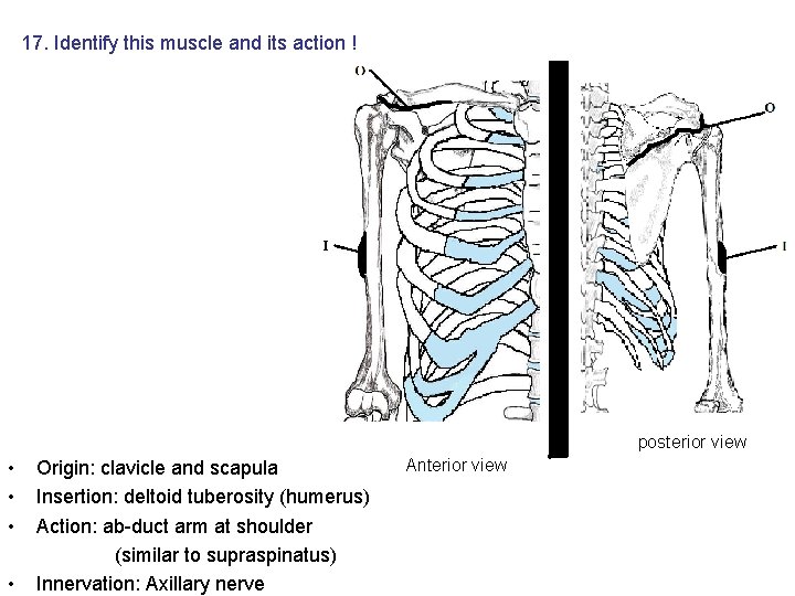 17. Identify this muscle and its action ! posterior view • • Origin: clavicle 17. Identify this muscle and its action ! posterior view • • Origin: clavicle