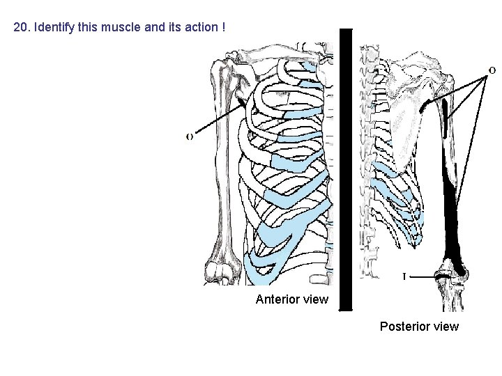 20. Identify this muscle and its action ! Anterior view Posterior view 20. Identify this muscle and its action ! Anterior view Posterior view